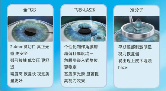 準(zhǔn)分子激光手術(shù)到底是怎么治 愈你的眼睛的？